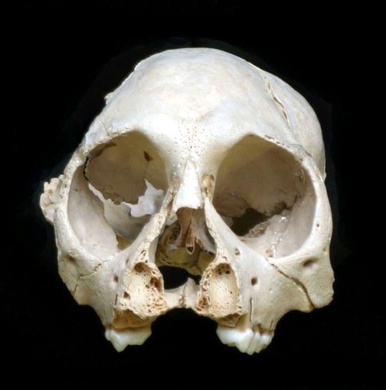 The skull of Antillothrix Bernensis. This specimen was found in Altagracia in 2009.